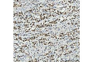 IHC analysis of PC4/SUB1 using anti-PC4/SUB1 antibody (ABIN7602185). (SUB1 Antikörper  (AA 62-127))