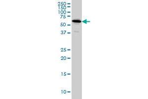NDOR1 monoclonal antibody (M01A), clone 3A11 Western Blot analysis of NDOR1 expression in HeLa . (NDOR1 Antikörper  (AA 498-595))