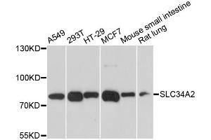 Western blot analysis of extracts of various cell lines, using SLC34A2 antibody. (SLC34A2 Antikörper)