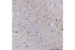 IHC analysis of BCAT1 using anti-BCAT1 antibody (ABIN7602594).