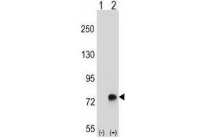 Western blot analysis of TGFBI (arrow) using rabbit polyclonal TGFBI Antibody (N-term) . (TGFBI Antikörper  (N-Term))