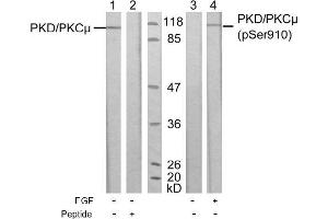 Image no. 1 for anti-Protein Kinase D1 (PRKD1) (pSer910) antibody (ABIN196785) (PKC mu Antikörper  (pSer910))