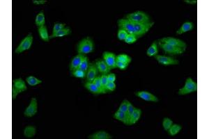 Immunofluorescence staining of HepG2 cells with ABIN7168811 at 1:400, counter-stained with DAPI. (SEMA5A Antikörper  (AA 201-400))