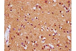 IHC image of ABIN7154582 diluted at 1:200 and staining in paraffin-embedded human brain tissue performed on a Leica BondTM system. (DIRAS1 Antikörper  (AA 1-195))