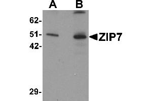Western Blotting (WB) image for anti-Solute Carrier Family 39 (Zinc Transporter), Member 7 (SLC39A7) (N-Term) antibody (ABIN1031683) (SLC39A7 Antikörper  (N-Term))