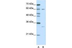 Western Blotting (WB) image for anti-Zinc Finger Protein 395 (ZNF395) antibody (ABIN2460665) (ZNF395 Antikörper)
