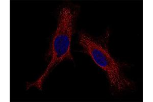 Indirect immunostaining of HELA cells (dilution 1 : 100; red). (Syntaxin 4 Antikörper  (AA 1-273))