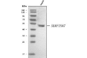 Western blot analysis of Thyroxine Binding Globulin/SERPINA7 using anti-Thyroxine Binding Globulin/SERPINA7 antibody (ABIN7602019). (SERPINA7 Antikörper  (AA 55-389))