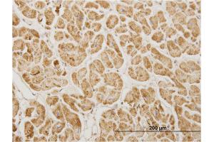 Immunostaining (ISt) image for anti-NADH Dehydrogenase (Ubiquinone) 1 alpha Subcomplex, 5, 13kDa (NDUFA5) (AA 1-116) antibody (ABIN948173)