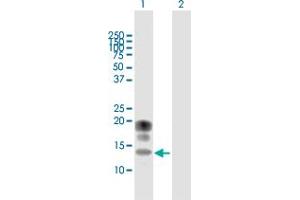 Western Blot analysis of KCNE1 expression in transfected 293T cell line by KCNE1 MaxPab polyclonal antibody. (KCNE1 Antikörper  (AA 1-129))