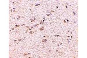 Immunohistochemistry (IHC) image for anti-Discs, Large (Drosophila) Homolog-Associated Protein 1 (DLGAP1) (Middle Region) antibody (ABIN1031076) (DLGAP1 Antikörper  (Middle Region))