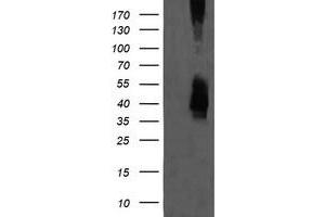 Image no. 1 for anti-Mitogen-Activated Protein Kinase Kinase 3 (MAP2K3) antibody (ABIN1499419) (MAP2K3 Antikörper)