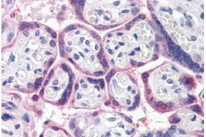 Human Placenta (formalin-fixed, paraffin-embedded) stained with ATG16L1 antibody ABIN351447 at 5 ug/ml followed by biotinylated goat anti-rabbit IgG secondary antibody ABIN481713, alkaline phosphatase-streptavidin and chromogen. (ATG16L1 Antikörper  (Internal Region))