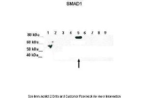 Lanes:   Lane 1: 5ug of transfected 293T lysate (SMAD1)  Lane 1: 5ug of transfected 293T lysate (SMAD2)  Lane 1: 5ug of transfected 293T lysate (SMAD3)  Lane 1: 5ug of transfected 293T lysate (SMAD4)  Lane 1: 5ug of transfected 293T lysate (SMAD5)  Lane 1: 5ug of transfected 293T lysate (SMAD6)  Lane 1: 5ug of transfected 293T lysate (SMAD7)  Lane 1: 5ug of transfected 293T lysate (SMAD8)  Lane 1: 5ug of transfected 293T lysate (GFP)  Primary Antibody Dilution:   1:1000  Secondary Antibody:   Goat anti-Rabbit IgG HRP Conjugated  Secondary Antibody Dilution:   1:10,000  Gene Name:   SMAD5  Submitted by:   Amanda Urick, Medical College of Wisconsin (SMAD5 Antikörper  (Middle Region))