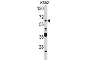 Western blot analysis of PAX3 Antibody (N-term) in K562 cell line lysates (35ug/lane). (Paired Box 3 Antikörper  (N-Term))