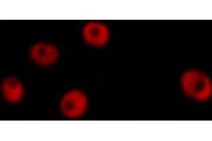 Immunofluorescence (fixed cells) (IF/ICC) image for anti-Lamin A/C (LMNA) (pSer392) antibody (ABIN6256311)