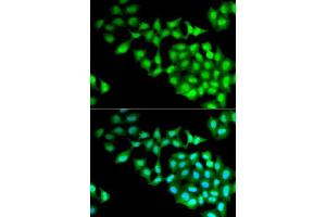 Immunofluorescence analysis of MCF7 cells using RNGTT antibody. (RNGTT Antikörper  (AA 1-260))