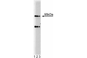Western blot analysis of Villin on HCT-8 lysate. (Villin 1 Antikörper  (AA 1-827))