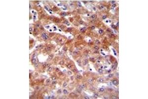 Formalin fixed, paraffin embedded Human liver tissue stained with CYP1A2 Antibody (Center) followed by peroxidase conjugation of the secondary antibody and DAB staining. (CYP1A2 Antikörper  (Middle Region))