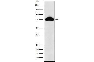 Western blot analysis of CD66b expression in Human plasma lysate.