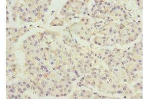 Immunohistochemistry of paraffin-embedded human pancreatic tissue using ABIN7150518 at dilution of 1:100 (DNAJB2 Antikörper  (AA 215-324))