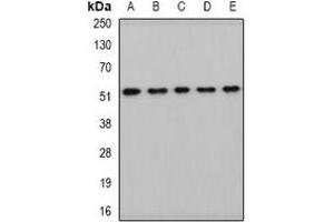Western blot analysis of HARS2 expression in HepG2 (A), mouse kidney (B), mouse heart (C), rat liver (D), rat brain (E) whole cell lysates.