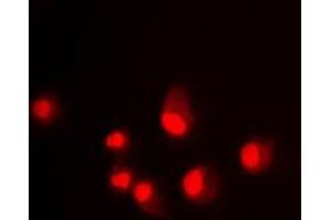 Immunofluorescent analysis of MDM2 staining in Jurkat cells.