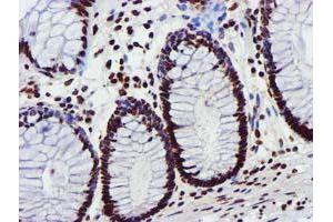 Image no. 9 for anti-Glutathione S-Transferase theta 2 (GSTT2) antibody (ABIN1498553) (GSTT2 Antikörper)