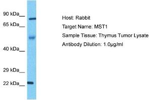 Host: Rabbit Target Name: MST1 Sample Type: Thymus Tumor lysates Antibody Dilution: 1. (MST1 Antikörper  (N-Term))