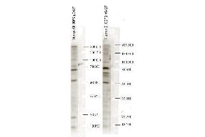 Western blot analysis is shown using anti-SH3BP2 pS427 antibody to detect endogenous protein present in unstimulated human whole cell lysates). (SH3BP2 Antikörper  (pSer427))