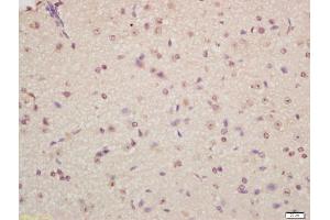Formalin-fixed and paraffin embedded mouse brain labeled with Anti-Musashi 1/Msi1 Polyclonal Antibody, Unconjugated (ABIN1387744) at 1:200 followed by conjugation to the secondary antibody and DAB staining (Musashi 1/2 (AA 66-150) Antikörper)