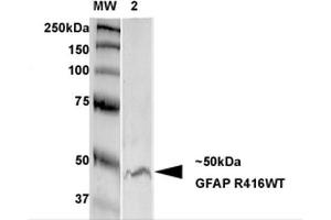 Western Blot analysis of Rat Brain Membrane showing detection of GFAP protein using Mouse Anti-GFAP Monoclonal Antibody, Clone S206B-9 . (GFAP Antikörper  (AA 411-422) (HRP))