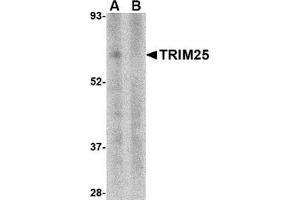 Western blot analysis of TRIM25 in human thymus tissue lysate in (A) the absence and (B) presence of blocking peptide with this product at 1 μg/ml. (TRIM25 Antikörper  (N-Term))