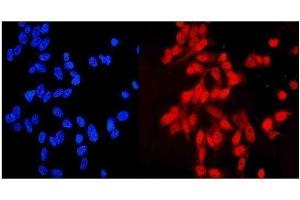 IF analysis of NDC80 using anti-NDC80 antibody (ABIN7602585).