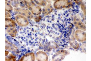 Immunohistochemistry (IHC) image for anti-Flotillin 2 (FLOT2) (AA 169-344) antibody (ABIN3042393)