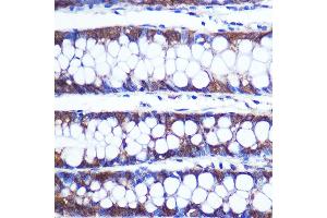 Immunohistochemistry of paraffin-embedded Human colon using TOP1MT Rabbit pAb (ABIN7270851) at dilution of 1:100 (40x lens).