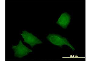 Immunofluorescence of monoclonal antibody to IREB2 on HeLa cell. (IREB2 Antikörper  (AA 1-343))