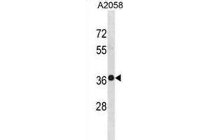 Western Blotting (WB) image for anti-TruB Pseudouridine (Psi) Synthase Homolog 2 (TRUB2) antibody (ABIN3001393) (TRUB2 Antikörper)