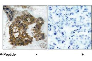 Image no. 1 for anti-V-Akt Murine Thymoma Viral Oncogene Homolog 2 (AKT2) (pSer474) antibody (ABIN196826) (AKT2 Antikörper  (pSer474))