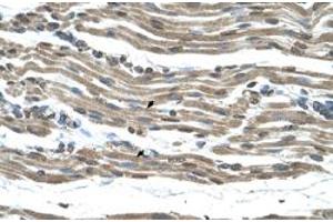 Immunohistochemical staining (Formalin-fixed paraffin-embedded sections) of human muscle with COX15 polyclonal antibody  at 4-8 ug/mL working concentration. (COX15 Antikörper  (N-Term))