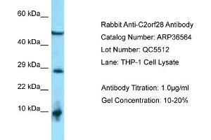 WB Suggested Anti-C2orf28 Antibody   Titration: 1. (ATRAID Antikörper  (C-Term))