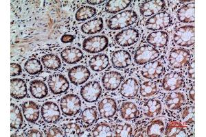 Immunohistochemistry (IHC) image for anti-Protein tyrosine Phosphatase, Receptor Type, J (PTPRJ) (Internal Region) antibody (ABIN6285228)