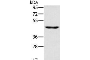Western Blot analysis of Human fetal brain tissue using SLC16A8 Polyclonal Antibody at dilution of 1:200 (MCT3 Antikörper)
