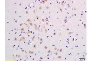 Formalin-fixed and paraffin embedded rat brain labeled with Rabbit Anti JNK1/2/3 Polyclonal Antibody, Unconjugated (ABIN747713) at 1:200 followed by conjugation to the secondary antibody and DAB staining