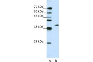 Western Blotting (WB) image for anti-Adenosine Deaminase, tRNA-Specific 1 (ADAT1) antibody (ABIN2462240)