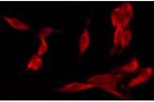 ABIN6267429 staining HeLa by IF/ICC. (NFKB1 Antikörper  (pSer932))