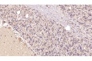 Detection of PTHR2 in Human Cerebellum Tissue using Monoclonal Antibody to Parathyroid Hormone Receptor 2 (PTHR2) (PTH2R Antikörper  (AA 27-145))