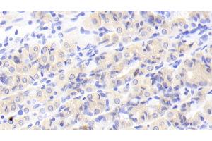 Immunohistochemistry (IHC) image for anti-Mannosidase, Alpha, Class 1A, Member 1 (MAN1A1) (AA 322-653) antibody (ABIN7441493)