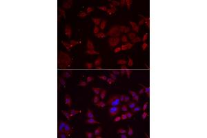 Immunofluorescence analysis of U2OS cell using PFKFB3 antibody. (PFKFB3 Antikörper)
