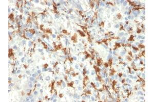 Formalin-fixed, paraffin-embedded human Kidney stained with AIF1 / Iba1 Mouse Monoclonal Antibody (AIF1/2493). (Iba1 Antikörper  (AA 1-146))